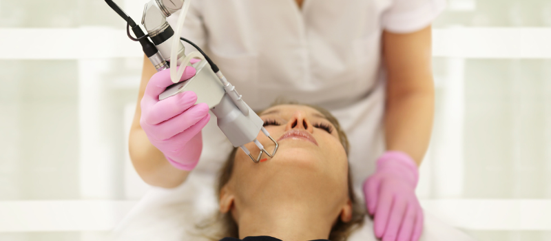 laser treatments have revolutionized skincare