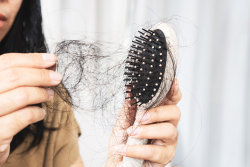 Common Causes of Hair Loss in Women