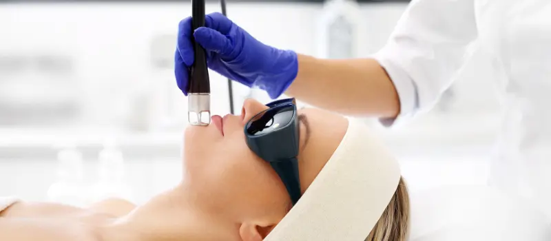 Say Goodbye to Acne Scars with Laser Scar Removal