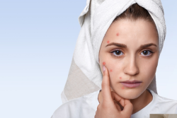  Stop Popping Pimples: Your Skin Deserves Better!