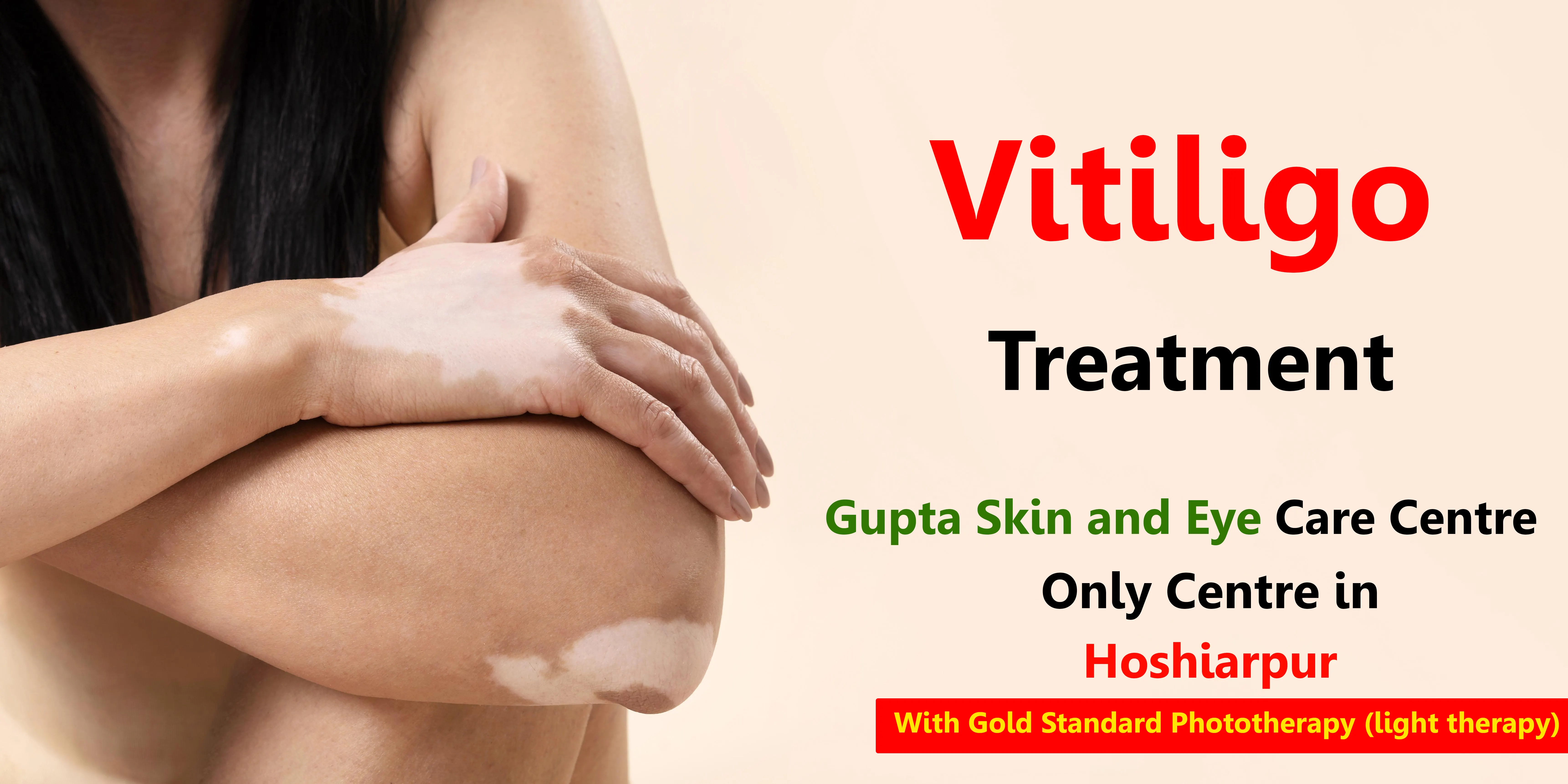 Understanding Vitiligo: Insights from Dr. Amit Gupta (Dermatologist)